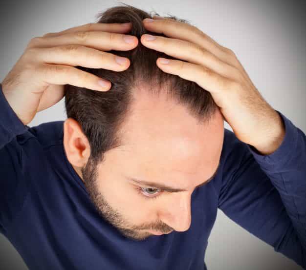 Alopecia Treatment