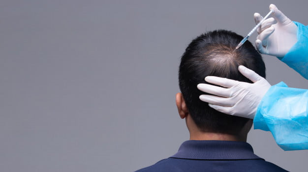 عملية زراعة الشعر